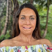 Turia Pitt shares her advice for getting through a tough time as a mum
