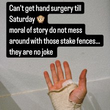 Isabelle Cornish reveals stake fence injury
