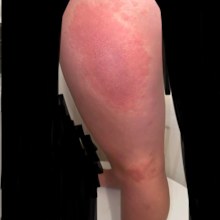 Mum warns against deadly 'poison hemlock' plant after daughter's horrible reaction.