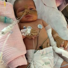  Little Molly Cranstone’s family face an agonising few months as they wait to find out if their baby will be able to eat normally.