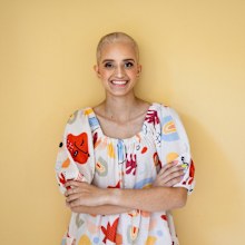 Julia Sandlant after losing her hair during cancer treatment.