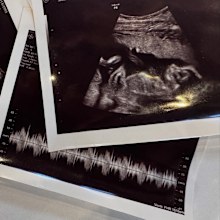 Debby Ryan and Josh Dun announce pregnancy