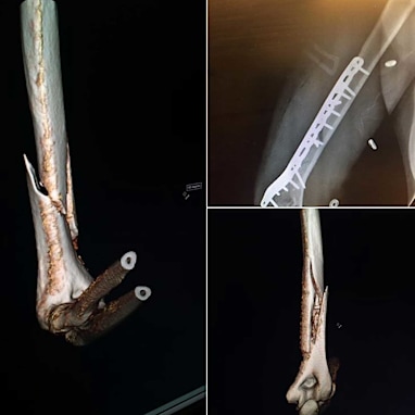 Vonn shows off gruesome injury