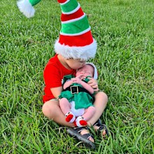 brothers born with Hirschsprung's disease rare life-threatening condition