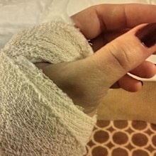 Barbara's wrist injury made the remainder of her cruise painful and uncomfortable.