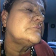 A victim of a violent road rage incident has spoken out about the peak hour attack, which left her with cuts and bruises to her face and hands