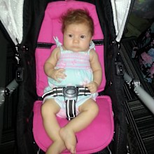The swelling is clear in this photo of Mia-Rose as a baby.