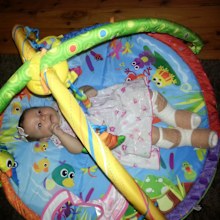 From a young age, Mia-Rose had to have her legs and feet bandaged to prevent further swelling.
