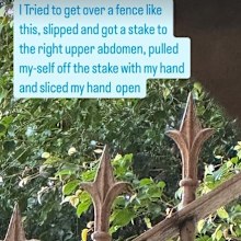 Isabelle Cornish reveals stake fence injury