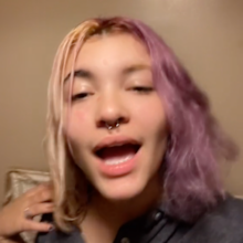 Teen suffers severe allergic reaction after dyeing her own hair: 'Scary experience'