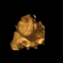 FETAP (FETAL TASTE PREFERENCES) STUDY, FETAL AND NEONATAL RESEARCH LAB, DURHAM UNIVERSITY.