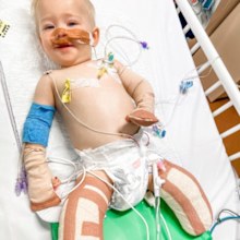 Jessica Carnie son Ryan had both legs amputated after contracting streptococcal A