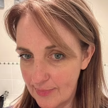 Tracy South Australia skin cancer