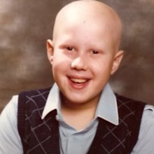 Little Britain star Matt Lucas opens up about battle with alopecia.