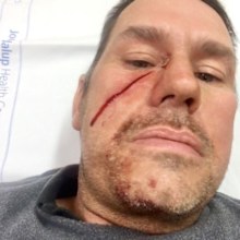 Mr Taylor says he was shocked by how much blood was pouring from the injury.