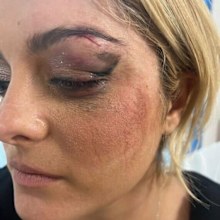 Bebe Rexha rushed off stage after being hit by fan's phone