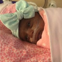 Girl believed to be tiniest newborn weighed as much as apple