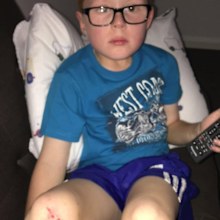 Charlie Mone Duchenne muscular dystrophy