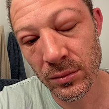 Zach Gilford shares shocking health update