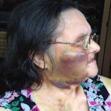 Elizabeth Hannaford was assaulted in an Adelaide nursing home after repeatedly pulling cords out of her bed. 