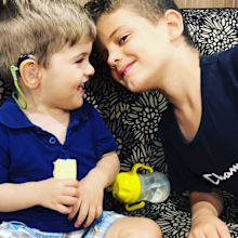 Miller Hypertonia and Global Developmental Delay disability