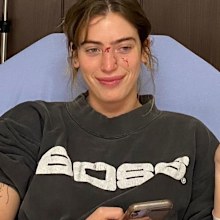 Ewan McGregor's daughter Clara McGregor bitten by dog before movie premiere.
