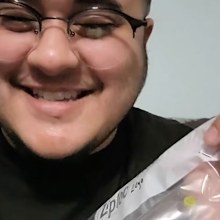 Andi Norton lego piece stuck up nose 26 years