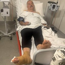 The 60-year-old is recovering at home after the stolen car ran over his foot.