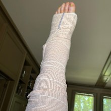 Martha Stewart shared a photo of her foot wrapped in bandages.