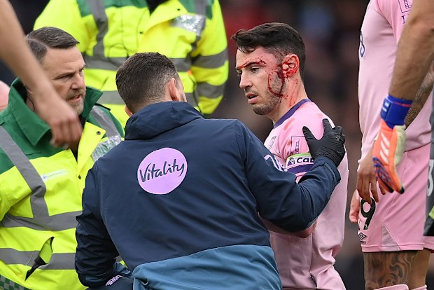 Adam Smith of Bournemouth receives treatment after clashing heads with Tyler Adams.
