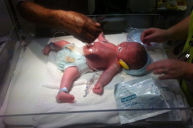 He was revived several times in his first few hours of life.