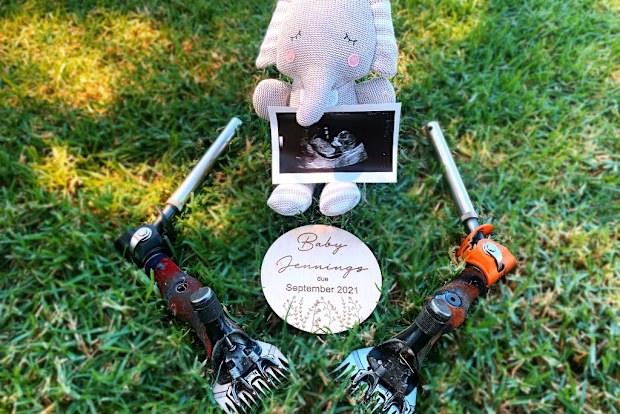Ally Costas ultrasound photo.