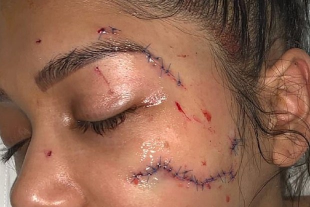 Parramatta DV victim glassed by ex-boyfriend