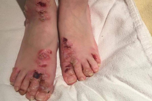 Zoe feet