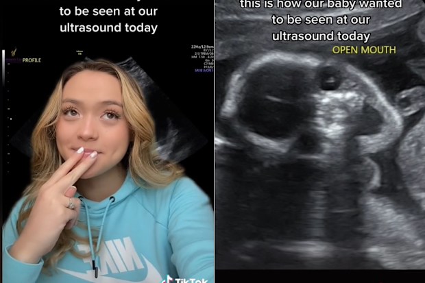 TikTok mum shows 'terrifying' baby on ultrasound. 