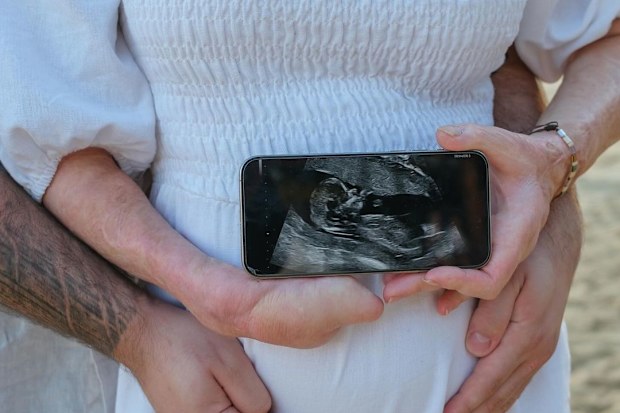 Sophie Delezio reveals she is expecting her first child: 'Greatest gift of all'