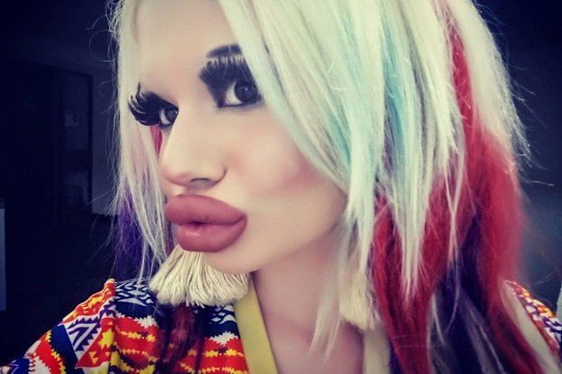 Andrea Emilova Ivanova aiming for the biggest lips in the world