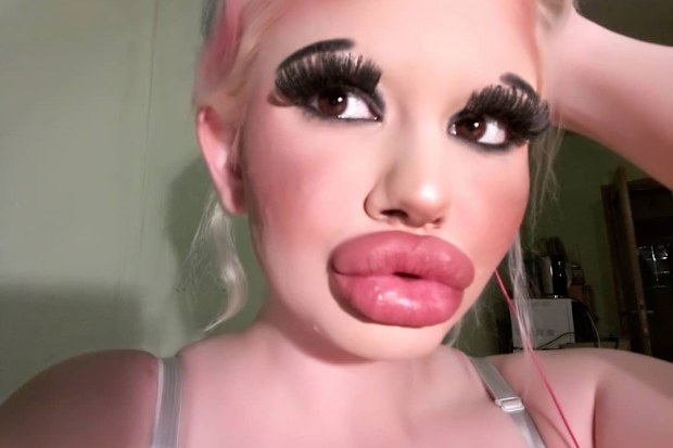 Andrea Emilova Ivanova aiming for the biggest lips in the world