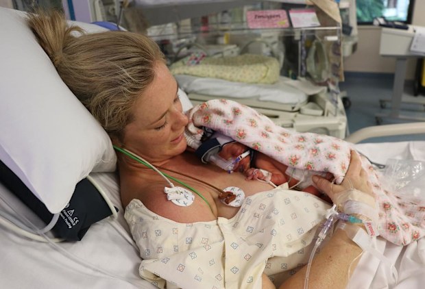 Sam Squiers with daughter Imogen after her premature birth.