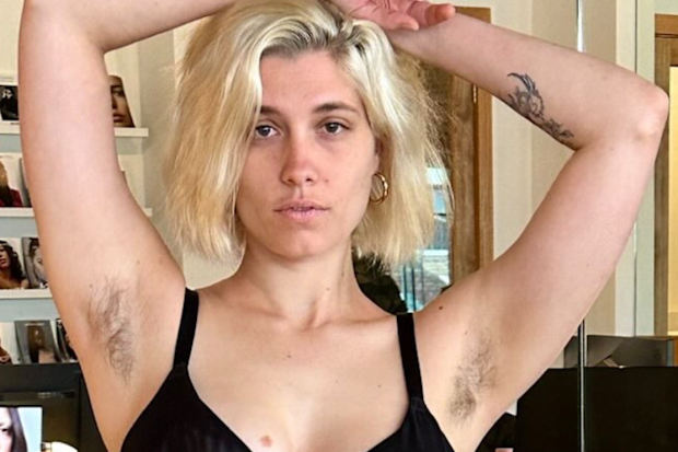Lea Combres knew the reason she wasn't booking modelling jobs was because of her body hair.