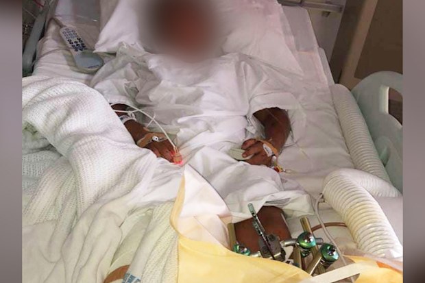 One of the other injured boys had part of his leg amputated in hospital. 