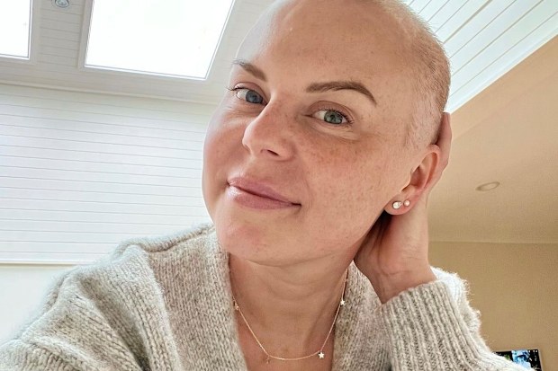 Keely Langshaw lost her hair in the process of cancer treatment.