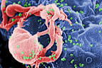 <p>T﻿he AIDS health crisis began on June 5, 1981, when a curious report published by US government health experts described five cases of a rare lung infection in young otherwise healthy gay men in Los Angeles.</p><p>Over the ensuing decades, acquired immunodeficiency syndrome (AIDS) – the devastating advanced-stage of HIV infection would go on to claim the lives of more than 40 million people globally.</p>