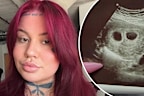 veruca salt pregnancy split