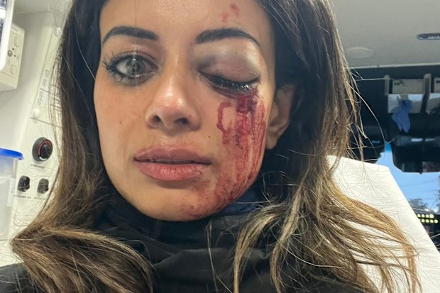 Hannah Thomas was badly injured following an anti-Israel protest in Sydney's west. 