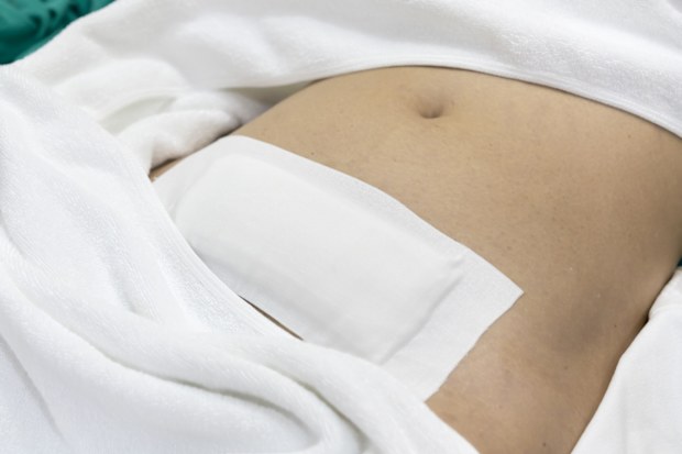After having Hysterectomy surgery by laparotomic myomectomy , patient given waterproof bandages for stitches