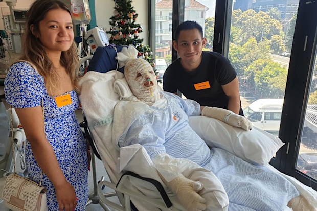 Stephanie Browitt spent two weeks in a come after the volcano eruption left her with third degree burns on 65 per cent of her body.