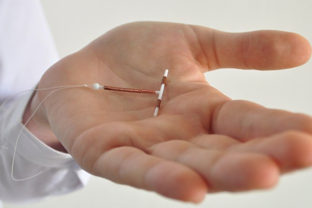 IUD in woman's abdomen