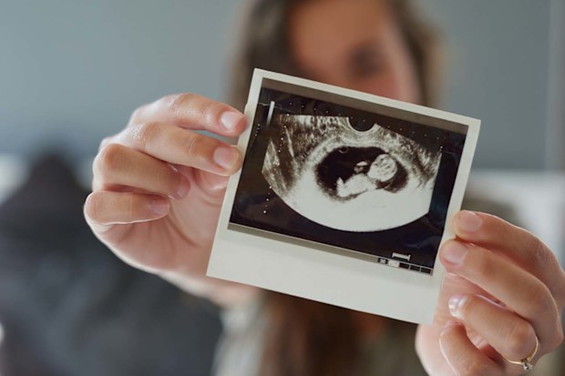 Woman showing pregnancy scan
