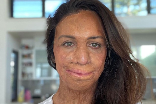 Turia Pitt